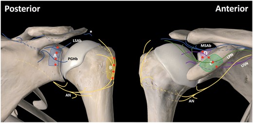 Shoulder terminal sensory articular nerve radiofrequency ablation for ...