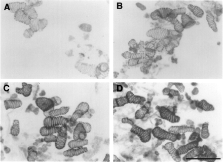 Fig. 4 Light micrographs of phloroglucinol staining of cells cultured for 101 h in fresh medium (A) or in conditioned media which had been used for culture at each cell density (B, 0.05×105 cells ml–1, C, 0.2×105 cells ml–1, and D, 0.8×105 cells ml–1) as described in Fig. 3. Cells were stained with 1% phloroglucinol in 20% HCl. Bar: 100 µm.