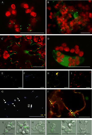 Fig. 2 Expression of fluorescent proteins in tobacco cells (A–J) and P. pastoris (K–P). Transient expression of different GFP–SO constructs are shown: GFP::SO-SNL (A), GFP::SO-SGL (B), GFP::SO-ANG (C) and SO-DEL::GFP (D). Co-localization of YFP-SKL (E) and GFP::SO-SNL (F) is shown in (G). For better clarity in (F), we coloured GFP blue so that white dots as merged colour represent perfect matches of the two fluorescent proteins. A merged image of transient expression of GFP::SO-SNL (H) and labelling with MitoTracker-Red (I) is shown in (J), chlorophyll autofluorescence of chloroplasts is coloured green. Images of P. pastoris strains (wild type: K,N; ΔPex7: L,O; ΔPex5: M,P), stably transformed with GFP–SKL (K–M), GFP::SO-SNL (N–P) are shown. The figures are merged images of DIC (Nomarsky) and GFP fluorescence. For more details see results. The bars represent 20 µm (A–J) and 10 µm (K–P), respectively. Arrows: in (G) blue for GFP::SO-SNL, yellow for YFP-SKL and white for co-localization and in (J) red for MitoTracker, yellow for GFP::SO-SNL and green for a chloroplast.