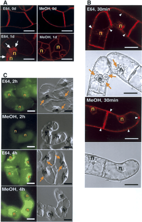 contribution of the plasma membrane and central vacuole in the fig 1 the localization of autolysosomes in cultured tobacco cells on the endocytic pathway by