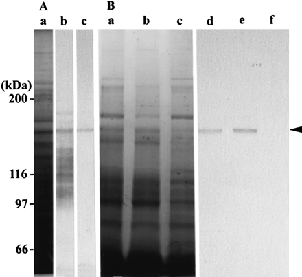 Fig. 2 Characterization of antibody. (A) Crude protein sample from wild-type Arabidopsis seedlings. CBB-stained gel (a), and immunoblotting with an antiserum against MYA2 peptide (b), or with the affinity-purified antibody from the serum (c). (B) F-actin co-sedimentation fraction. CBB-stained gel (a, b and c) and immunoblotting (d, e and f) with the affinity-purified antibody against MYA2 peptide. F-actin was added to the crude extract prepared from seedlings. After centrifugation, the pellet (a and d) was suspended in a solution containing ATP, and further centrifuged. The resulting supernatant (b and e) and pellet (c and f) were electrophoresed with the first pellet (a and d) on the same gel. The arrowhead indicates the 170 kDa polypeptide recognized by the antibody. The molecular masses of standard proteins are indicated at the left in kDa.