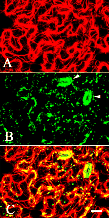 Fig. 5 Immunolocalization of actin and MYA2 in epidermal cells of leaf. Double labeling was carried out with anti-actin antibody (A) and affinity-purified antibody against MYA2 peptide (B). A merged image is shown in (C). Most of the small dots and punctate signals frequently formed lines or clusters co-localized with actin filaments. Labeling was very prominent in guard cells (arrowhead in B). Scale bar = 10 µm.