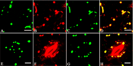 Fig. 8 Co-localization of MYA2 and peroxisomes in transgenic Arabidopsis expressing GFP-tagged peroxisomal targeting signal peptide 1. GFP signals in epidermal (A) and guard cells (E) from live transgenic leaves. Double labeling of epidermal (B, C and D) and guard cells (F, G and H) with the affinity-purified antibody against MYA2 (B and F) and the anti-GFP antibody (C and G). Merged images are shown in (D) and (H). Some large, punctate signals from anti-MYA2 antibody overlapped with those from anti-GFP antibody, whereas many small, green dots were unique. Scale bars = 10 µm (A–D) and 5 µm (E–H).