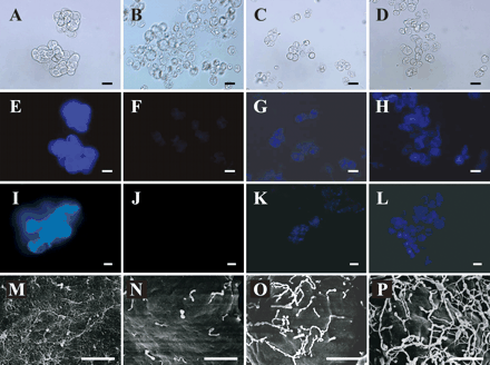 Fig. 1 Time course of changes in the cell surface during cell wall regeneration from the protoplasts of Arabidopsis suspension-cultured cells. Cells and protoplasts stained with Calcofluor White M2R (E–H) and aniline blue (I-L) were observed under a differential interference contrast microscope (A–D) and an epifluorescent microscope (E–L). For scanning electron microscopic observation (M–P), cells and protoplasts were fixed in glutaraldehyde and ruthenium tetroxide, and then coated with silver. Native suspension-cultured cells (A, E, I and M), fresh protoplasts (B, F, J and N), protoplasts regenerated for 1 h (C, G, K and O) and those regenerated for 3 h (D, H, L and P) are shown. Bar: 25 µm (A–L); 1.5 µm (M–P)