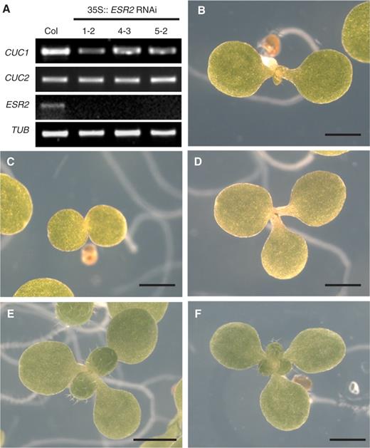  Phenotypes of ESR2 knock-down seedlings. (A) Semi-quantitative RT–PCR analysis of the expression of CUC1, CUC2, ESR2 and TUBULIN (control) in wild-type (Col) and 35S :: ESR2 RNAi seedlings. Root explants at 6 d after transfer onto SIM were used for RNA preparation. (B) Seven-day-old wild-type seedling grown on MS agar medium. (C and D) Seven-day-old ESR2 RNAi seedlings with incompletely fused cotyledons in (C), and with triple cotyledons in (D). (E and F) Ten-day-old ESR2 RNAi seedlings grown on MS medium either with two true leaves in (E), or with three true leaves in (F). Bars = 1 mm. 