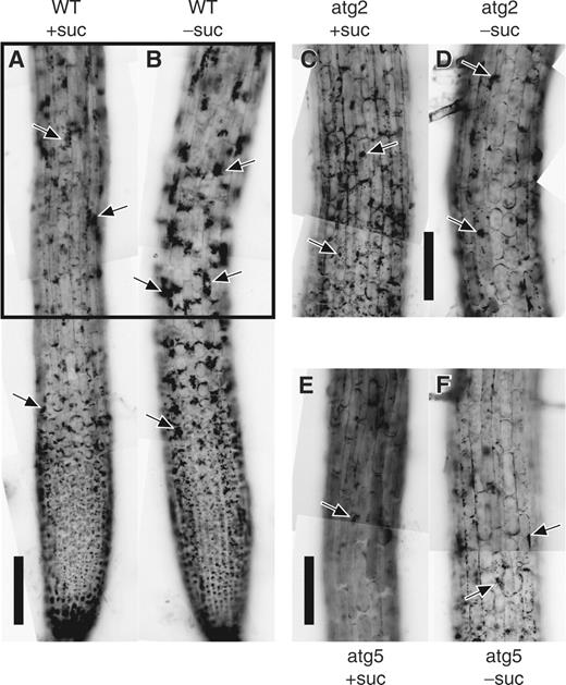  Activation of autophagy in Arabidopsis root tips by sucrose deprivation. Root tips from the wild-type of the Columbia ecotype (WT) and atatg2-1 (atg2) and atatg5-3 (atg5) mutant seedlings of Arabidopsis were incubated in culture medium containing (+suc) or lacking (−suc) sucrose in the presence of E-64d for 1 d. They were stained with neutral red and observed. The parts corresponding to that enclosed by a rectangle in the WT are shown in the mutants. Arrows point to vacuolar inclusions. Bar = 100 μm. 