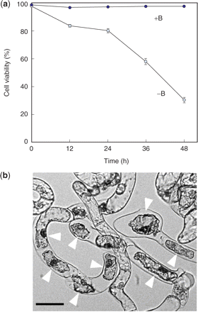 Cell death induced by B deprivation. (a) The time-dependent change of cell viability. Cells were washed with and cultured in control (+B) or B-free (−B) media and were examined for viability with FDA/PI staining. Values represent the percentage of FDA-stained live cells, which is an average of the results obtained from four randomly selected fields. (b) Morphology of dead cells in −B culture. Cells were observed under bright-field microscopy 48 h after treatment. Arrowheads indicate dead cells. Bar = 50 μm.