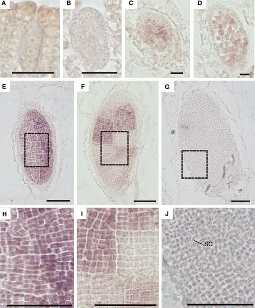 Spatial expression pattern of a PHD-finger TF gene (CUFF.8237) in developing antheridia. RNA in situ hybridization images with an antisense probe of developing antheridia from early to late stages (A–G). Enlargements of spermatogenous tissue in dashed line boxes of E–G are shown (H–J, respectively). SC, sperm cell (J). Low magnification images of the sections hybridized with antisense and sense probes are shown in Supplementary Fig. S2 . Scale bar = 10 µm (A–D) and 200 µm (E–J).