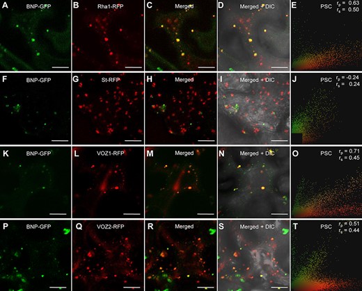 BNP co-localizes with VOZ1 and VOZ2 to Rha1-positive vesicles. (A, F, K and P) Localization of BNP–GFP transiently expressed in N. benthamiana epidermal cells. (B) Fluorescent marker for late endosomes/prevacuolar compartments/multivesicular bodies, RFP–Rha1. (C) Merged image of BNP–GFP and RFP–Rha1. (D) An overlay with the corresponding bright-field image. (E, J, O and T) PSC test calculated using a plugin for ImageJ; r values indicate the level of co-localization ranging from +1 for perfect co-localization to −1 for negative correlation. (G) Fluorescent marker for Golgi apparatus, St–RFP. (H) Merged image of BNP–GFP and St–RFP. (I) An overlay with the corresponding bright-field image. (L) Localization of RFP–VOZ1. (M) Merged image of BNP–GFP and RFP–VOZ1. (N) The corresponding bright-field image of the cells shown in (M). (Q) Localization of RFP–VOZ2. (R) Merged image of BNP–GFP and RFP–VOZ2. (S) Bright-field image of the cells shown in (R). Bars = 20 µm.