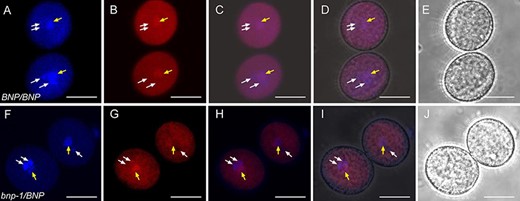 VOZ1 localization in mature pollen from WT and bnp-1/BNP plants. Mature pollen from (A–E) BNP/BNP, VOZ1–RFP and (F–J) bnp-1/BNP, VOZ1–RFP plants was analyzed. Representative z-stack images of confocal micrographs displaying (A, F) DAPI nuclear staining, (B, G) VOZ1–RFP fluorescence and (E, J) bright-field images. (C, H) Merged DAPI and VOZ1–RFP fluorescence images and (D, I) merged DAPI, VOZ1–RFP fluorescence and bright-field images. Arrows indicate the vegetative nucleus (central position) and the generative nuclei (peripheral positions) in each pollen grain. Bars = 10 µm.