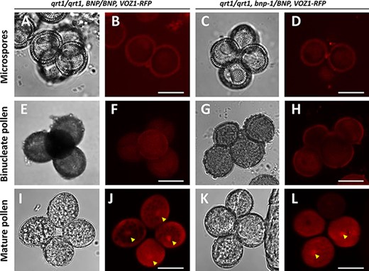 Nuclear localization of VOZ1 is affected in bnp mutants. Pollen tetrads from qrt1/qrt1, BNP/BNP, VOZ1–RFP (A, B, E, F, I and J) and qrt1/qrt1, bnp-1/BNP, VOZ1–RFP (C, D, G, H, K and L) plants were analyzed at microspore (A–D), binucleate (E–H) and mature tricellular (I–L) stages. Representative z-stack images of confocal micrographs displaying VOZ1–RFP fluorescence (B, D, F, H, J and L) and bright-field images (A, C, E, G, I and K) are shown. Arrowheads indicate nuclear localized VOZ1. Bars = 10 µm.