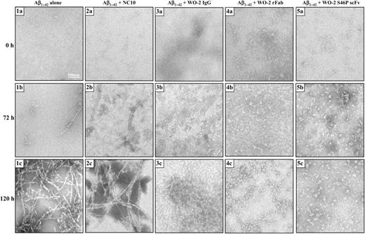 TEM analysis of Aβ1–42 fibril formation with WO-2 IgG and its recombinant fragments. Aβ1–42 was incubated alone (1a, 1b and 1c) or in the presence of an NC10 scFv (2a, 2b and 2c), WO-2 IgG (3a, 3b and 3c), WO-2 chimeric rFab (4a, 4b and 4c), WO-2 S46P scFv (5a, 5b and 5c). Images were captured by TEM at time 0 (1a, 2a, 3a, 4a and 5a), 72 h (1b, 2b, 3b, 4b and 5b) and 120 h (1c, 2c, 3c, 4c and 5c). Scale bar, 100 nm.