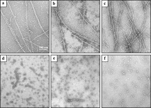 TEM analysis of the disaggregation of Aβ1–42 fibrils by WO-2 IgG and its recombinant fragments. Aβ1–42 preformed fibrils were confirmed by TEM (a) and then incubated alone (b) or in the presence of an NC10 scFv (c), WO-2 IgG (d), WO-2 chimeric rFab (e) and WO-2 S46P scFv (f) at RT for 24 h.