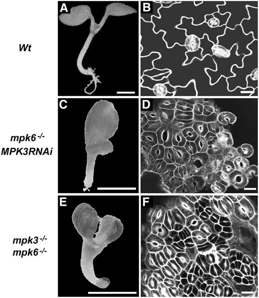 Stomatal Development in Wild-Type, mpk6−/− MPK3RNAi, and Rescued mpk3−/− mpk6−/− Seedlings.