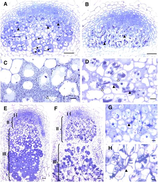 Microscopy Characterization of efd-1 Nodules Reveals Defects in Symbiosome Formation and Tissue Differentiation.