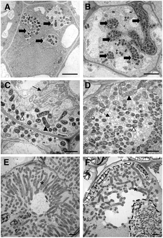 EM Characterization of Zones II and III Cells from Wild-Type M. truncatula and efd-1 10-d-Old Nodules.