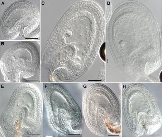 Ovule and Seed Phenotypes of zix before Fertilization and 3 DAP.
