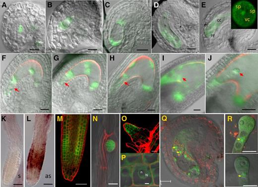 ZIX-GFP Protein Localization in Gametophytes, Early Seeds, and Roots.