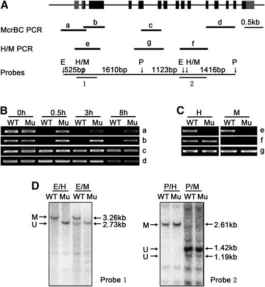 DNA Hypomethylation in the 5′ Region of FIE1 in Epi-df.
