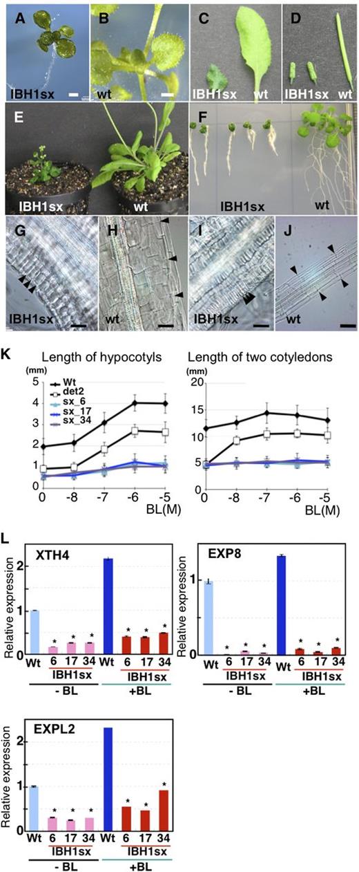 Analyses of Pro35S:IBH1-SRDX Plants.