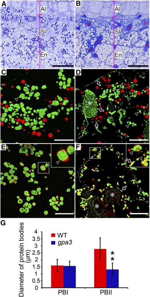 Light and Immunofluorescence Microscopy Images of Protein Bodies in the Subaleurone Cells of the Wild Type and the gpa3 Mutant.