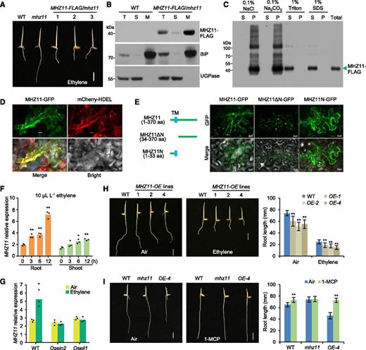 MHZ11 Is Localized to the ER Membrane and Positively Regulates Ethylene Signaling.