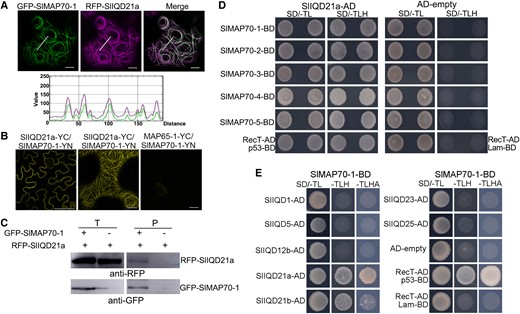 SlMAP70 proteins interact with tomato SlIQD21a. A) RFP-SlIQD21a colocalized with GFP-SlMAP70-1 in N. benthamiana leaf epidermal cells. The GFP signal of SlMAP70-1 fusion protein along the white line superposed with the RFP signal of SlIQD21a fusion protein. Bars: 10 µm. B) BiFC assays of protein interaction between SlMAP70-1 and SlIQD21a in N. benthamiana leaf epidermal cells. YFP fluorescence was visible along the CMT filamentous structure. The N-terminal (YN) and C-terminal fragments (YC) are fused to proteins of SlMAP70-1 and SlIQD21a, respectively. MAP65-1-YC served as negative controls. Bars: 10 µm. C) GFP-Trap–based Co-IP assay of GFP-SlMAP70-1 and RFP-SlIQD21a; the blot was detected using an RFP antibody. RFP-SlIQD21a was only found in the pellet fraction in the presence of GFP-SlMAP70-1. D) Y2H analysis indicates SlIQD21a interacts with all SlMAP70 proteins. p53 + RecT indicates positive control, and Lam + RecT indicates negative control. E) Y2H assay of interactions between SlMAP70-1 and other selected SlIQD proteins. For Y2H, all the strains could grow on synthetic dropout media without Trp and Leu (SD/-TL), whereas only positive strains could grow on SD/-LTH (SD/-Trp/-Leu/-His) media, and strong positive strains also could grow on SD/-LTHA (SD/-Trp/-Leu/-His/-Ade).