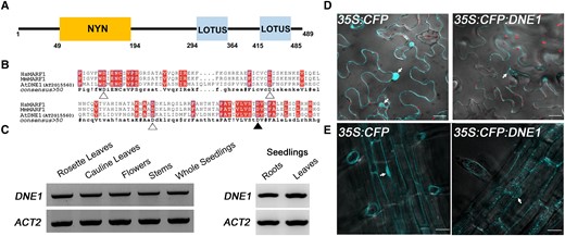 Arabidopsis DNE1 is an NYN domain-containing protein that localizes to the cytoplasm. A) Schematic illustration of the domain architecture of Arabidopsis DNE1. NYN, endoribonuclease domain; LOTUS, RNA-binding domain. B) Amino acid sequence alignment of the NYN domains of Arabidopsis DNE1 and metazoan MARF1. Shaded boxes, conserved residues. Triangles, residues required for ssRNase activity (Yao et al. 2018); filled triangle, D153 residue used in subsequent mutational analysis. Hs, human; Mm, mouse; At, Arabidopsis. C) RT-PCR results showing the DNE1 and ACT2 genes are expressed in each of the different Arabidopsis organs tested. The location of primers (6958 and 6959) amplifying 1 kb region of the 1.47 kb DNE1 CDS is shown in Supplemental Fig. S1. RNA was isolated from two-week-old seedlings grown on solid germination media and six- to eight-week-old adult plants grown in soil. Gel images are representative of three biological replicates. D) Transient expression of CFP and CFP:DNE1 in N. benthamiana leaves captured on an LSM880 multiphoton confocal microscope. Scale bars, 25 μm. E) Stable expression of CFP and CFP:DNE1 in transgenic Arabidopsis roots captured on a Dragonfly spinning disk confocal microscope. Images are representative of two independent T2 lines. Scale bars, 40 μm. For D) and E), overlaid images of fluorescence and differential interference contrast (DIC) are shown as a single slice from a z-stack maximum intensity projection. Arrows, selected nuclei in individual epidermal cells.