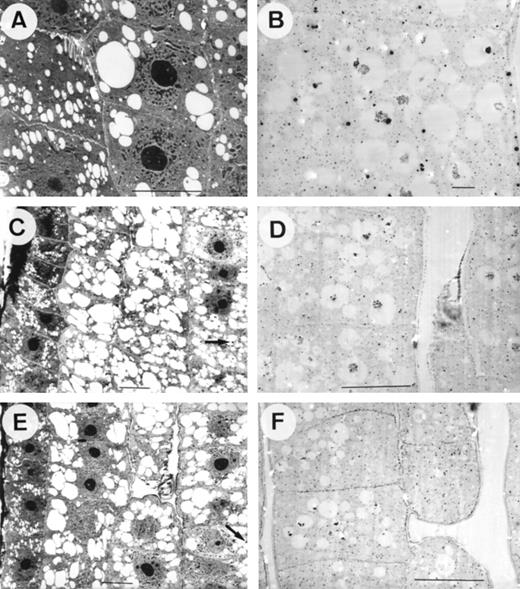 TEM images from longitudinal sections of root tips of maize plants exposed for 0 (A and B) or 4 h (C–F) to control (0 μm Al) (A–D) or 20 μm Al (E and F) containing nutrient solution. A, C, and E, Glutaraldehyde-fixed samples. B, D, and F, PA-stained samples. Note the abundance of electron-translucent vacuoles with only some peripheric electron-dense deposits (C and E, arrows) in conventionally fixed samples and the abundance of electron-dense precipitates in the central part of vacuoles from PA-stained samples (B, D, and F). All scale bars represent 10 μm, except B, where bar is 1 μm.
