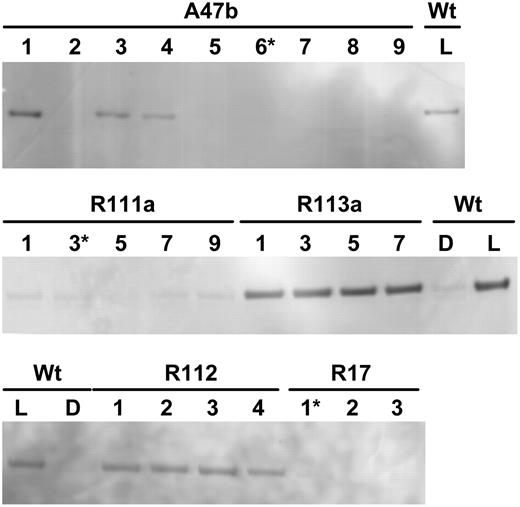 Immunodetection of phosphorylated PEPC in leaf extracts of F. bidentis. Shown is wild type (Wt) and progeny of several primary transformants (A47b, R111a, R113a, R17, R112) separated by SDS-PAGE. For wild type, leaf discs were collected during the dark period (D) or 3 h into the light period (L) of the growth cabinet. Leaf samples for the progeny were all collected 3 h into the light period. (Progeny marked with an asterisk were grown to seed.) Samples were loaded on gels on an equal-leaf-area basis. Phosphorylated PEPC was detected with the specific antibody and with anti-IgG alkaline phosphatase conjugate (Bio-Rad) as secondary antibody. Immunoblots were developed using the AttoPhos fluorescence substrate system (Promega). There were no other bands on the membrane.