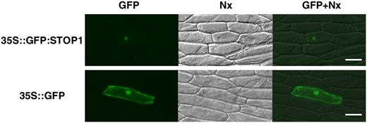 Localization of the GFP∷STOP1 protein that was transiently expressed in onion epidermis cells. Vectors containing CaMV35S∷GFP:STOP1 (top) or CaMV35S∷GFP (bottom) were introduced by particle bombardment. Fluorescence images (left) and bright-field images (middle) are merged at right. Bars = 100 μm.