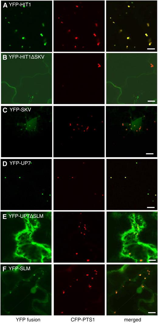 Identification of two novel PTS1 tripeptides, SKV> and SLM>. Confocal images were obtained from leaf epidermal cells of 4-week-old tobacco plants coexpressing the indicated YFP fusions and the CFP-PTS1 peroxisomal marker. Bars = 10 μm.