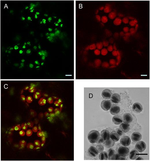 Subcellular localization of LSF1 in N. benthamiana leaves. A, Confocal microscopy of leaf cells transiently expressing 35S∷LSF1-GFP, showing the localization of GFP fluorescence. B, Chlorophyll autofluorescence of the same image. C, Merged fluorescence from A and B. D, Light micrograph of chloroplasts isolated from leaf protoplasts and stained with iodine. The dark objects in the chloroplasts are starch granules. Images were taken in the middle of the photoperiod. Bars = 5 μm.