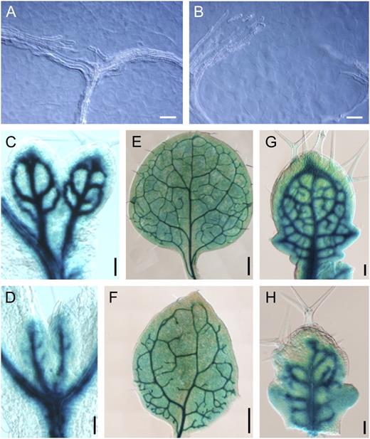 Decreased connectivity in ron1-1 leaf veins. A and B, Vascular strands from the apex of Ler (A) and ron1-1 (B) first-node leaves. C to H, GUS activity in leaves obtained from the first two nodes (C–F) and the fifth node (G and H) of ATHB-8-GUS transgenic plants in Wassilewskija (C, E, and G) and ron1-1 (D, F, and H) backgrounds. Interference contrast micrographs were taken at 5 DAS (C and D), 12 DAS (E and F), and 23 DAS (G and H). Bars = 40 μ m (A and B), 50 μ m (C, D, G, and H), and 200 μ m (E and F).