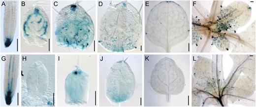 DR5-GUS expression in ron1-1. Root tips (A and G), first-node leaves (B–E and H–K), and incipient leaves (F and L) of DR5-GUS transgenic plants in Col-0 (A–F) and ron1-1 (G–L; mixed Ler/Col) backgrounds. Photographs were taken at 4 DAS (A and G), 5 DAS (B and H), 7 DAS (C and I), 8 DAS (D and J), and 14 DAS (E, F, K, and L). Bars = 100 μ m (A–D, F–J, and L) and 1 mm (E and K).