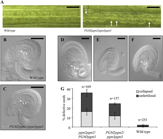 Seed and ovule development in the wild type compared to PGM2pgm2/pgm3pgm3 and pgm2pgm2/PGM3pgm3 mutants. Results for PGM2pgm2/pgm3pgm3 and pgm2pgm2/PGM3pgm3 mutants were the same. Only PGM2pgm2/pgm3pgm3 is shown. A, Siliques of the wild type and the PGM2pgm2/pgm3pgm3 mutant. White arrows indicate aborted seeds. Bars = 1 mm. B, Representative light microscopy picture of unfertilized ovules of the wild type. CC, Central cell. C, Representative light microscopy picture of unfertilized ovules of the PGM2pgm2/pgm3pgm3 mutant. Ovules from pgm2pgm2/PGM3pgm3 mutants were indistinguishable from the other two genotypes. D to F, Seeds of self-pollinated PGM2pgm2/pgm3pgm3 mutants 3 d after pollination were categorized into normal wild-type-like (D), collapsed (E), and unfertilized (F) seeds. Em, Embryo. pgm2pgm2/PGM3pgm3 mutants showed essentially a comparable distribution into the same categories. In B to F, bars = 50 μm. G, Quantification of the percentage of wild-type-like and defective seeds (as shown in D–F) in the three genotypes. n, Number of seeds counted.