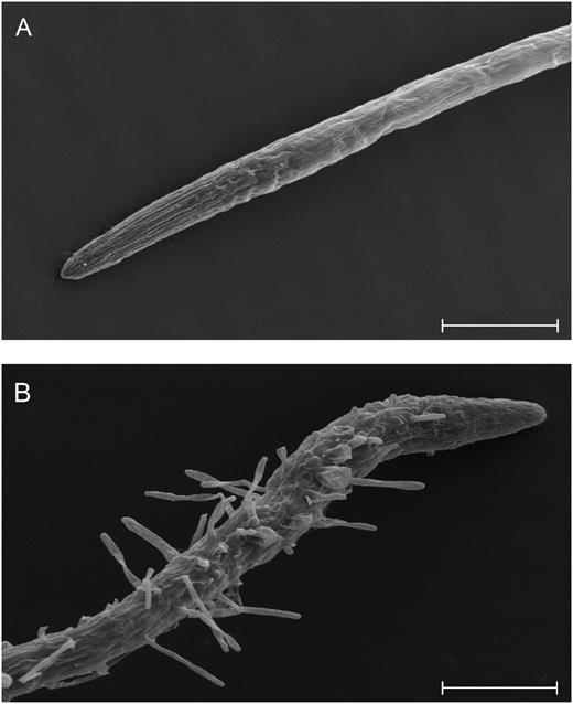 Scanning electron microscopy images of 6-d-old estradiol-treated Ws wild-type and RNAi R2-4A mutant seedlings showing root swelling and ectopic root hair development. A, Enlarged apical zone of Ws wild-type root. B, Enlarged apical zone of R2-4A root. These results are representative of three or more biological repeats. Bars = 200 µm.