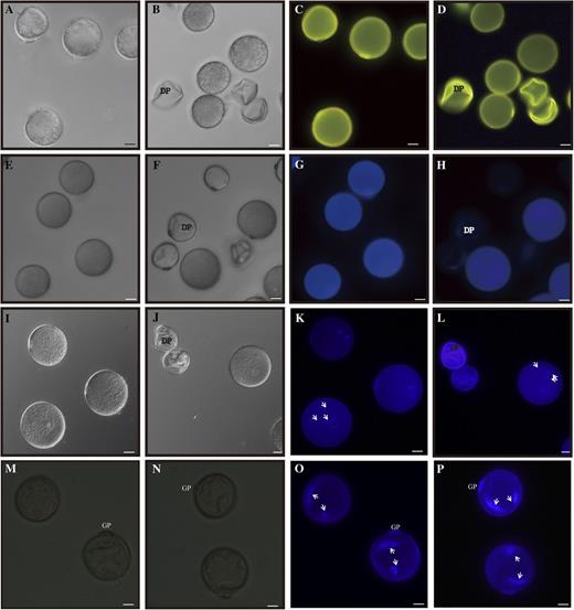 Phenotypes of pollen grains. A to D, Auramine O staining of grains from segregating wild-type (A and C) and OsGT1/osgt1-1 (B and D) plants at stage 12 observed under bright-field (A and B) and fluorescence (C and D) microscopy. E to H, Calcofluor white staining of pollen grains from segregating wild-type (E and G) and OsGT1/osgt1-1 (F and H) plants at stage 12 observed under bright-field (E and F) and fluorescence (G and H) microscopy. I to P, DAPI staining of pollen grains from segregating wild-type (I, K, M, and O) and OsGT1/osgt1-1 (J, L, N, and P) plants at stage 12 (I–L) and stage 11 (M–P) plants observed under bright-field (I, J, M, and N) and fluorescence (K, L, O, and P) microscopy. Arrows indicate nucleus. DP, Defective pollen. Bars = 20 μm.