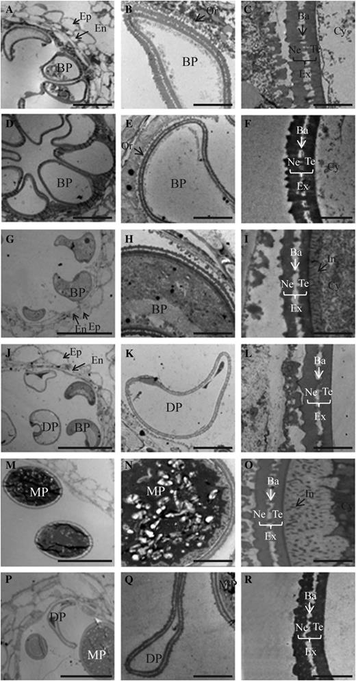 TEM analyses of developing anthers from wild-type (A–C, G–I, and M–O) and OsGT1/osgt1-1 (D–F, J–L, and P–R) plants at stage 11a (A–F), stage 11b (G–L), and stage 12 (M–R). Ba, Bacula; BP, binuclear pollen; Cy, cytosol; DP, defective microspores; En, endothecium; Ep, epidermis; Ex, exine; In, intine; MP, mature pollen; Ne, nexine; Or, orbicule; SG, starch granule; Te, tectum. Bars = 10 μm (A, D, G, J, M, and P), 2 μm (B, E, H, K, N, and Q), and 0.5 μm (C, F, I, L, O, and R).