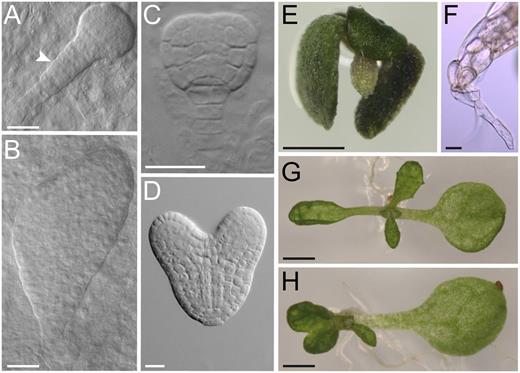 Embryonic and early seedling phenotypes of the rer3-3 mutant. Aberrant rer3-3 (A and B) and wild-type embryos (C and D) at the late globular (A and C) and heart (B and D) stages. A white arrowhead in A points to an abnormal suspensor. A rer3-3 seedling lacking basal structures (E) and details of its hypocotyl showing a single root hair at the tip (F). Some rer3-3 seedlings display a single cotyledon, either with a single first-node leaf (G) or with fused first-node pair leaves (H). Pictures were taken 45 (A–D) and 7 (E–H) das. Bars = 20 µm (A–D and F) and 1 mm (E, G, and H).