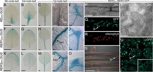 RER gene expression and RER3 protein localization. A to O, Expression of RE, RER1, and RER3 in leaves. GUS activity of REpro:GUS (A–E), RER1pro:GUS (F–J), and RER3pro:GUS (K–O) transgenic plants in the Col-0 background. Magnifications are shown for the spongy mesophyll (D, I, and N) and lateral hydathodes (E, J, and O). bsc, Bundle sheath cells. P to U, Expression of the RER3:GFP fusion protein. Detail of an epidermal cell from the hypocotyl (P–R), the root epidermis at the differentiation region (S), and cleared palisade mesophyll cells (T and U). Red channel: chlorophyll autofluorescence (R) or propidium iodide staining (S) of cell walls. ip, Immature plastids. Pictures were taken on samples harvested 11 das. Bars = 0.5 mm (A–C, F–H, and K–M), 40 µm (D, E, I, J, N, and O), and 20 µm (P–U).