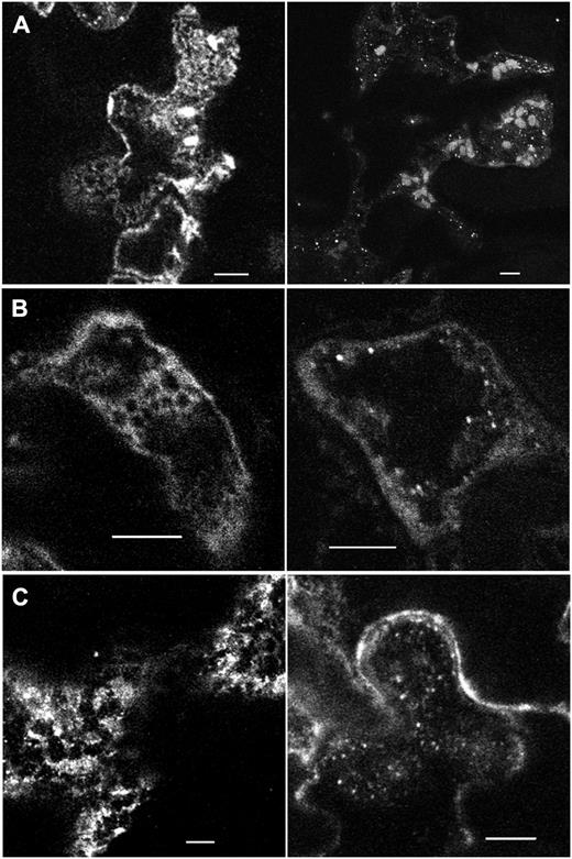 NAP1 has a complex punctate and reticulate pattern in cotyledon and leaf pavement cells at different developmental stages. A, Confocal image projection of NAP1 localization in 2-DAG wild-type cotyledon pavement cells. NAP1-positive reticulate and cylindrical structures are shown (left). NAP1-positive small punctae are highlighted (right). B, NAP1 localization patterns in 10-DAG wild-type cotyledon pavement cells. Localization patterns are displayed as in A. Image planes include a cortical subregion of the apical surface of a highly lobed, fully expanded cell. C, NAP1 localization patterns in 14-DAG wild-type leaf pavement cells. Localizations patterns are displayed as in A. Bars = 5 μm.