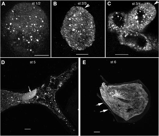 In trichomes, NAP1 transitions from a distributed population of punctae in growing cells from stages 1 through 5 to a reticulate pattern in fully expanded stage 6 cells. A, Immunolocalized NAP1 is concentrated at punctate structures that are distributed throughout a spherical stage 1 (st 1/2) trichome cell. The image shown is the maximum Z-projection of a confocal image stack of anti-NAP1 signal from nearly all of the cell volume. B, NAP1 localization in a cylindrical unbranched stage 2/3 (st 2/3) trichome that is at the transition to branch initiation. The arrowhead indicates the position of a small bulge that defines the position of a newly initiated branch. The confocal image is a Z-projection containing nearly all of the cell volume. C, NAP1 localization in a stage 4 (st 4) trichome that contains a short branch with a blunt tip. NAP1 is localized to punctate structures. The arrowhead indicates a blunt trichome branch tip at the stage when NAP1 is essential for polarized growth. The image is the maximum Z-projection of part of a confocal image stack that contains nearly all of the upper trichome. D, NAP1 localization in a stage 5 (st 5) trichome. NAP1 is localized to punctate structures and diffuse membrane structures. The large elliptical structure in the trichome’s stalk is the nucleus, as indicated by the arrow. The image is the maximum Z-projection of a confocal image stack. E, NAP1 localization in a stage 6 (st 6) trichome. NAP1 shows a reticulate structure and diffuse sheets of membrane. Punctate NAP1 structures were rarely found in this stage 6 cell. The arrows indicate the cell wall tubercles that define stage 6 cells that have ceased cell expansion. Bars = 5 μm in A and B and 10 μm in C to E.
