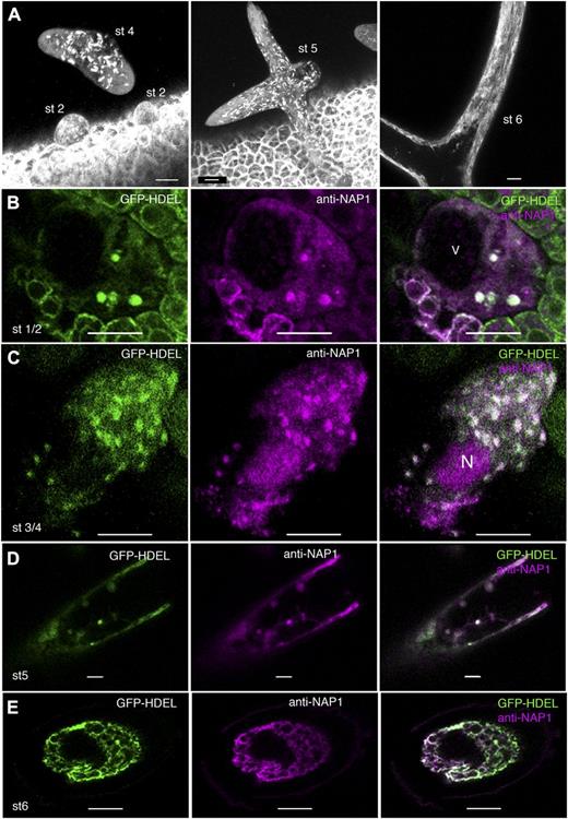 In expanding trichomes, the ER consists of a distributed population of nodule-like structures that strongly colocalize with NAP1. A, Localization patterns of GFP-HDEL in wild-type live-cell trichomes. GFP-HDEL is localized to punctate structures in early stage 2 (st 2) trichomes and slightly larger elliptical structures in stage 4 (st 4) trichomes, as shown by the maximum Z-projection of multiple confocal images. GFP-HDEL is localized to elliptical structures in stage 5 (st 5) trichomes, as shown by the maximum Z-projection of a confocal image stack containing most of the stage 5 trichome that is transitioning to a pointed branch tip morphology (middle). GFP-HDEL is localized to membrane sheets and extended tubules in stage 6 (st 6) trichomes, as shown by the maximum Z-projection of confocal images containing part of a stage 6 trichome (right). B, Single confocal image slice showing the colocalization between NAP1 (middle) and GFP-HDEL (left) in a stage 2 trichome at punctate structures, as shown by the white pixels (right). V, Lumen of the central vacuole. C, Single confocal image slice showing the colocalization between NAP1 (middle) and GFP-HDEL (left) in a stage 3/4 trichome at punctate structures, as shown by the white pixels (right). N, Nucleus. D, Single confocal image slice showing the colocalization between NAP1 (middle) and GFP-HDEL (left) in a stage 5 trichome containing punctate structures, as shown by the white pixels (right). E, Single confocal image slice showing the colocalization between NAP1 (middle) and GFP-HDEL (left) in a stage 6 trichome with a reticulate membrane organization, as shown by the white pixels (right). Bars = 10 μm in A to C and 5 μm in D and E.