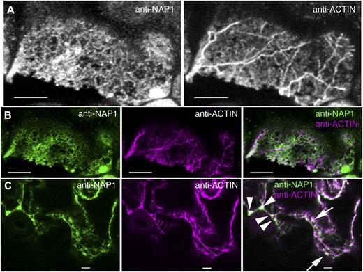 ER-localized NAP1 has a low level of colocalization with the actin cytoskeleton. A, Maximum Z-projection of seven confocal image slices from a wild-type leaf pavement cell double labeled for NAP1 (left) and actin (right). B, Single confocal image slices contained within the Z-projection in A. An example of the type of region of interest used for Pearson correlation coefficient is shown. Left, Single confocal image slice from the anti-NAP1 channel. Middle, Corresponding image slice from the actin channel. Right, Overlay image of two channels. C, Single confocal optical section showing the double labeling of NAP1 (left) and actin (middle) in wild-type pavement cells. Colocalization of NAP1 and actin was observed at three-way cell wall junctions (arrowheads) and punctate ER structures (arrows). Bars = 5 μm.