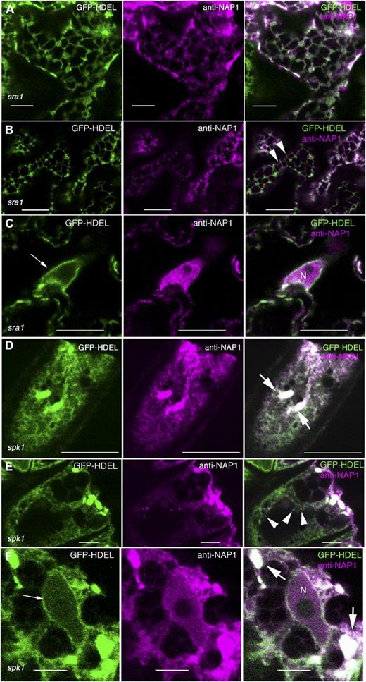 The general ER localization of NAP1 is independent of the integrity of W/SRC and SPK1-dependent positive regulation upstream SPK1 signaling. A to C, Localization of the GFP-HDEL ER marker (left) and NAP1 (middle) in the pavement cells of sra1. Single image planes are shown in all panels. Right, Overlay of the two false-colored image channels. A, NAP1 strongly colocalizes with GFP-HDEL in sra1 pavement cells, as shown by the white pixels (right). B, Punctate NAP1 adjacent to GFP-HDEL-positive ER was present in sra1, as shown by the arrowheads (right). C, NAP1 is present in the nucleus in sra1. GFP-HDEL labels the nuclear envelope, as shown by the arrow (left). D to F, Localization of the GFP-HDEL ER marker (left) and NAP1 (middle) in the pavement cells of spk1. Single image planes are shown in all panels. Right, Overlay of the two false-colored image channels. D, NAP1 strongly colocalizes with ER bodies and reticulate ER marked by GFP-HDEL in spk1 pavement cells, as shown by the white pixels (right). E, Punctate NAP1 adjacent to GFP-HDEL-positive ER was present in spk1, as shown by the arrowheads (right). F, NAP1 is present in the nucleus in spk1. Arrowheads indicate discrete NAP1 punctae, thick arrows indicate ER bodies, and thin arrows indicate nuclear membrane. N, Nucleus. Bars = 5 μm in A, E, and F and 10 μm in B to D.