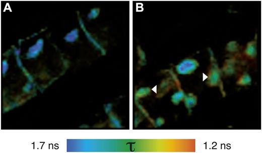 BFA compartments contain BRI1-SERK3 heterooligomers. A, Fluorescence lifetime image of BRI1-GFP labeled with rabbit anti-YFP and goat anti-rabbit-Alexa488. B, Fluorescence lifetime image of double-labeled BRI1-GFP and SERK3-HA with rabbit anti-YFP/goat anti-rabbit-Alexa488 and mouse anti-HA/goat anti-mouse-Alexa568, respectively. FRET-FLIM results from immunolabeled BRI1-GFP and SERK3-HA in roots of 5-d-old Arabidopsis seedlings coexpressing BRI-GFP 1 and SERK3-HA in response to BFA (50 µm BFA, 1 h) are shown. The BRI1-GFP1/SERK3-HA line used here is homozygous for both tagged receptors and has approximately twice the amount of endogenous BRI1 and SERK3 proteins (van Esse et al., 2011). Arrowheads indicate BFA compartments with reduced Alexa488 fluorescence lifetimes. The color bar represents the false color code for Alexa488 fluorescence lifetimes (τ).