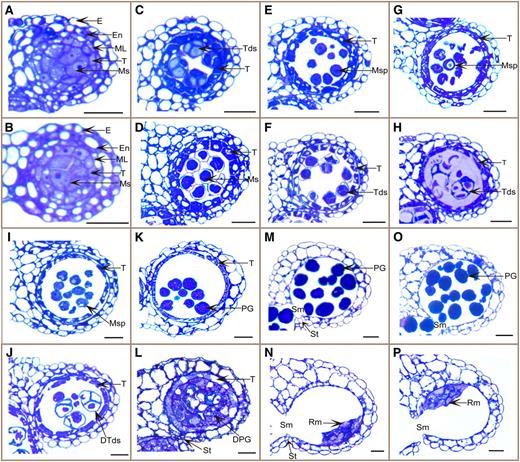 Comparison of wild-type and cdm1 anther development. Semithin anther sections were stained with toluidine blue, with one locule shown in each: the wild type (A, C, E, G, I, K, M, and O) and cdm1 (B, D, F, H, J, L, N, and P). A and B, At stage 6, five cell layers were presented and meiocytes underwent meiosis. C, At stage 7, tetrads were already formed. D, At stage 7, tetrads were not formed yet. E, At stage 8, individual microspores were released. F, At stage 8, meiocyte external wall was not degraded, and thinner than normal callose wall was formed between microspores. G, At stage 9, microspores became vacuolated. H, At stage 9, microspores in tetrads began to degenerate. I and J, At stage 10, tapetum degeneration was initiated in both the wild type and the cdm1 mutant. cdm1 microspores, which were undergoing degeneration, were still attached (J). K, At stage 11, pollen grains formed exine. L, At stage 11, microspores were almost completely degenerated, and masses of wall materials were found separately from the microspores in the locule. M and N, At stage 12, stomium was broken down. No pollen grains were generated, leaving remnants of microspores in the cdm1 mutant anther locule (N). O and P, At stage 13, stomium breakage allowed anther dehiscence and pollen grain release in the wild type (O). The cdm1 anther dehisced (P). DPG, Degenerating pollen grain; DTds, degenerating tetrad; E, epidermis; En, endothecium; ML, middle layer; Ms, meiocytes; MSp, microspore; PG, pollen grain; Rm, remnant of locule contents; Sm, septum; St, stomium; T, tapetum; Tds, tetrad. Bar = 20 μm.