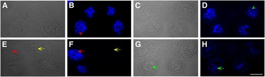 Aniline blue staining analysis for callose in the wild type and cdm1. Analysis of staining in wild-type anther sections (A, B, E, and F) and cdm1 anther sections (C, D, G, and H), using bright-field microscopy (A, C, E, and G) and UV light (B, D, F, and H). A and B, A wild-type stage 7 anther, showing that each newly formed microspore was enveloped with a thick callose wall (red arrowhead in B). C and D, A cdm1 stage 7 anther. Although newly formed microspores were separated by callose (green arrow head in D), the callose wall was thinner than that formed in the wild type (red arrowhead in B). E and F, A wild-type stage 8 anther (yellow arrows), showing that the callose wall had been completely degraded, and individual microspores were released. In the same flower, the neighboring younger anther still remained at stage 7 (red arrows) with a strong signal for callose. G and H, A cdm1 stage 8 anther, showing residual callose between microspores (green arrows). Bar = 50 μm.