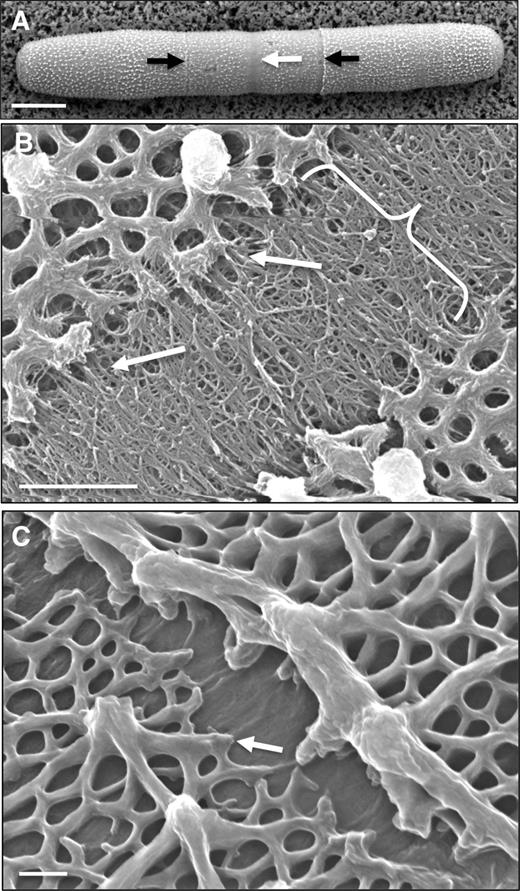 P. margaritaceum cell wall surface topology. A, VPSEM image of a P. margaritaceum cell showing the lattice of projections made of Ca2+-complexed HG on the outer surface. The central isthmus zone (white arrow) and secondary lateral bands (black arrows) are indicated. B, FESEM image showing the isthmus zone (bracketed). Arrows highlight examples of fibrils emerging from the isthmus and fusing with the adjacent lattice. C, FESEM image of a lateral band. The arrow indicates the globular edge of the HG-rich lattice with no adjacent fibrils. Bars = 12 µm (A), 1.5 µm (B), and 150 nm (C).